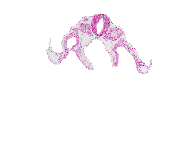 amnion attachment, dermatomyotome 9 (C-5), dorsal aorta, left umbilical vein, midgut, notochord, right umbilical vein, somitocoel 9