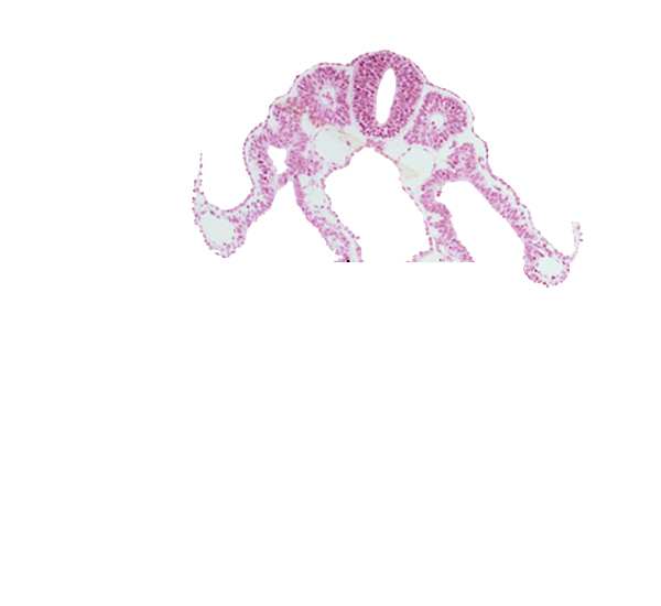 dermatomyotome 9 (C-5), intermediate mesenchyme, lateral body fold, midgut, notochord, somitocoel 9