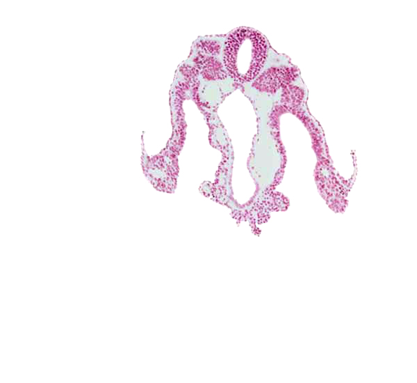 amnion attachment, amniotic cavity, communication between peritoneal cavity and extra-embryonic coelom, dorsal aorta, intermediate mesenchyme, notochord, peritoneal cavity, right umbilical vein, somite 11 (C-7), umbilical vesicle cavity, vitelline (omphalomesenteric) vein