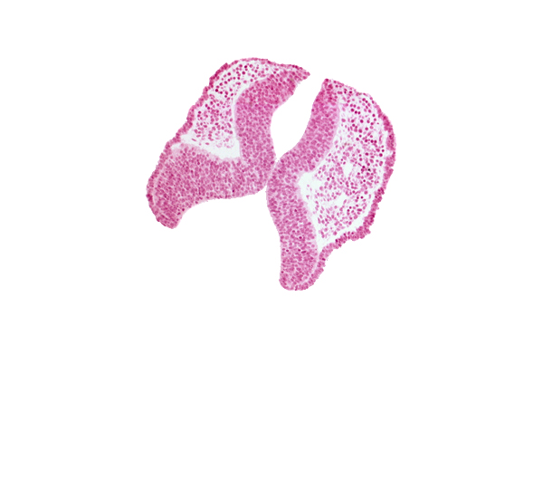 artifact space(s), cephalic neuropore, head mesenchyme, junction of neural ectoderm and surface ectoderm, neural fold [mesencephalon (M)], rhombencephalon (Rh. 1), surface ectoderm