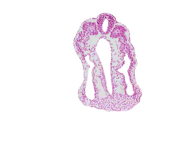 dorsal aorta, intermediate mesenchyme, neural tube, right umbilical artery, somite 13 (T-1), somitocoel 13