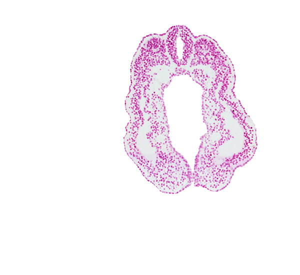 caudal part of peritoneal cavity (coelom), cloacal membrane, cloacal part of hindgut, dorsal aorta, dorsal aorta plexus