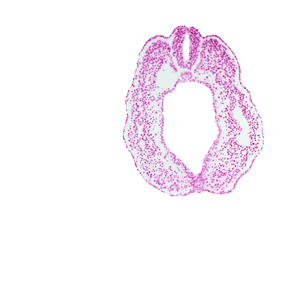 caudal part of peritoneal cavity (coelom), cloacal membrane, cloacal part of hindgut, dorsal aorta, dorsal aorta plexus, endoderm, fusing neural folds, intermediate mesenchyme, lumen of neural tube, paraxial mesoderm, perinotochordal lamina, somatopleure, splanchnopleure, surface ectoderm