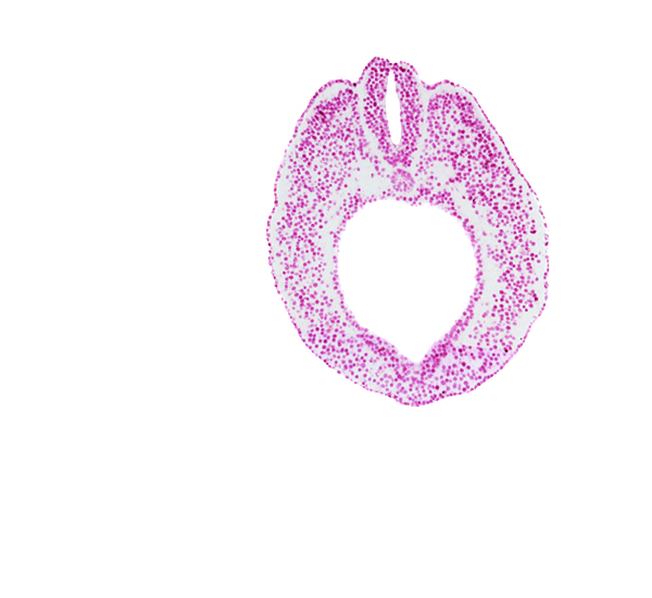 caudal edge of neural tube, cloacal part of hindgut, dorsal aorta plexus, endoderm, lateral mesoderm, lumen of neural tube, notochord, paraxial mesoderm, surface ectoderm