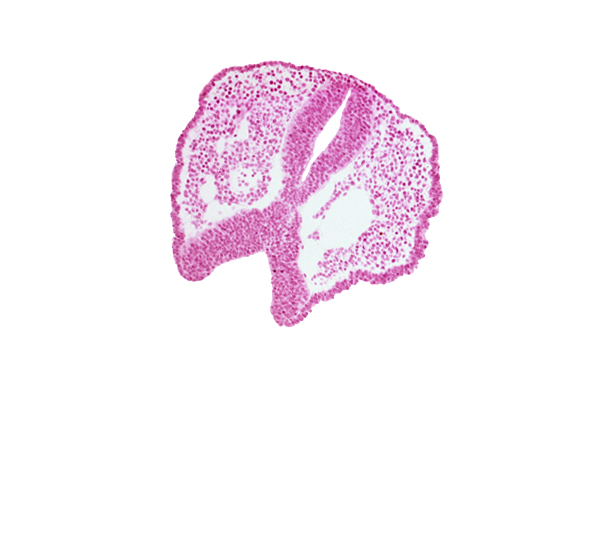 artifact space(s), chiasmatic plate (D1), dorsal aorta, floor plate [diencephalon (D2)], rhombencephalon (Rh. 2), tectum of mesencephalon, tegmentum of mesencephalon, trigeminal neural crest (CN V)