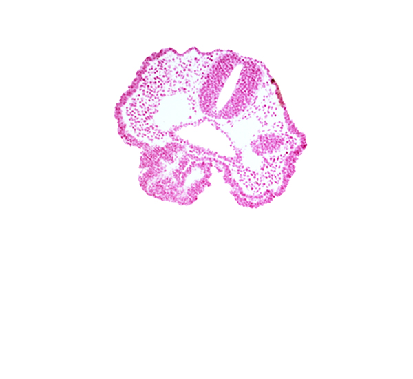 adenohypophysial pouch, aortic arch 1, cephalic edge of neural fold [telencephalon medium (T)], cephalic edge of pharyngeal pouch 1, dorsal aorta, endoderm, foregut lumen, junction of aortic arch 1 and dorsal aorta, mandibular prominence of pharyngeal arch 1, notochordal plate, oropharyngeal membrane, rhombencephalon (Rh. 2), surface ectoderm