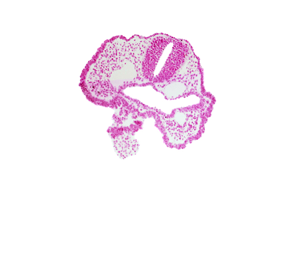 aortic arch 1, cephalic edge of heart prominence, dorsal aorta, ectodermal ring, edge of surface ectoderm, mandibular prominence of pharyngeal arch 1, notochordal plate, oropharyngeal membrane, pharyngeal arch 2, pharyngeal pouch 1, rhombencephalon (Rh. 2), stomodeum, trigeminal neural crest (CN V)