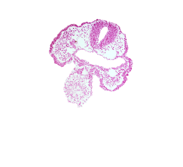 caudal part of stomodeum, cephalic part of heart prominence, head mesenchyme, neural tube, notochord, pharyngeal arch 2, pharyngeal groove 1, pharyngeal membrane, pharyngeal pouch 1, surface ectoderm, surface ectoderm (one layer)