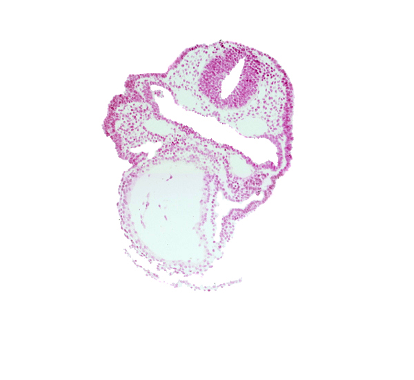 amnion, aortic arch 1, dorsal aorta, ectodermal ring, endocardium, epimyocardium, facio-vestibulocochlear neural crest (CN VII and CN VIII), mandibular prominence of pharyngeal arch 1, mesenchyme, notochordal plate, pericardial cavity, primary head vein, rhombencephalon (Rh. 4), surface ectoderm