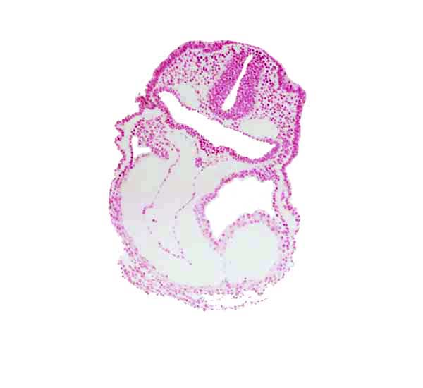 aortic sac, cardiac jelly, conotruncus, dorsal aorta, junction of aortic arch 1 and aortic sac, lateral pharyngeal recess, otic placode, rhombencephalon (Rh. 5), right ventricle