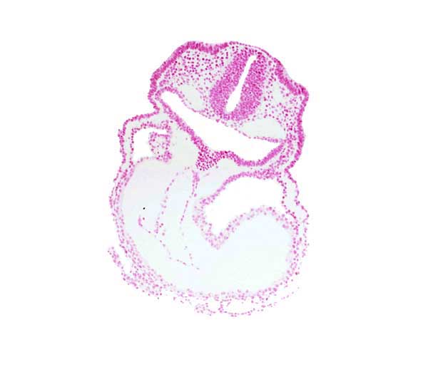 aortic sac, cardiac jelly, conotruncus, endocardium, epimyocardium, head mesenchyme, otic placode, pericardial cavity, primary head vein, rhombencephalon (Rh. 5), right ventricle, thyroid diverticulum