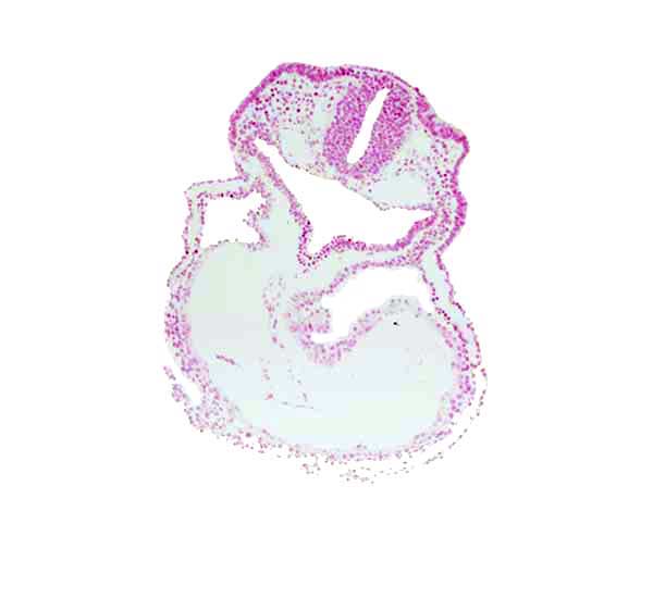 dorsal aorta, otic placode, pericardial cavity, primary head vein, right ventricle, thyroid diverticulum