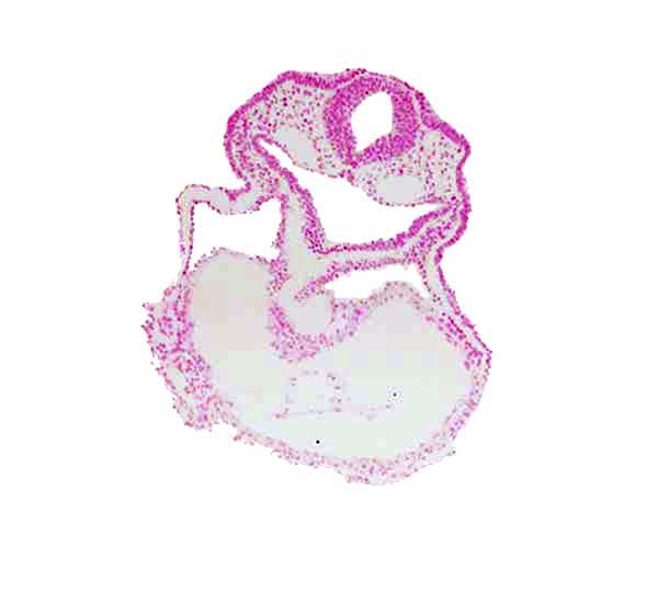 amnion attachment, cardiac jelly, caudal edge of thyroid diverticulum, dorsal aorta, epimyocardium, head mesenchyme, junction of left and right ventricles, lateral pharyngeal recess, mesocardium, notochordal plate, otic placode, pericardial cavity, rhombencephalon (Rh. 5), surface ectoderm