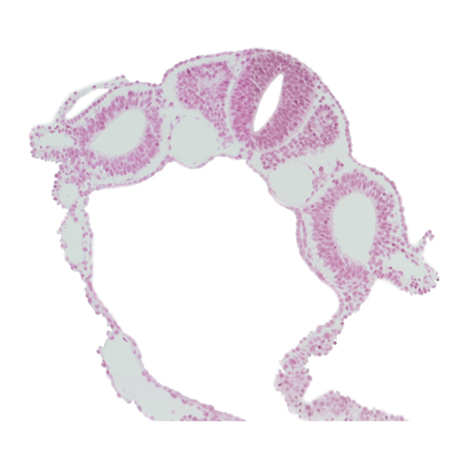 amnion attachment, caudal edge of dermatomyotome 4 (O-4), caudal edge of rhombencephalon (Rh. D), dorsal aorta, left umbilical vein, notochord, right umbilical vein, right vitelline (omphalomesenteric) vein, sclerotome