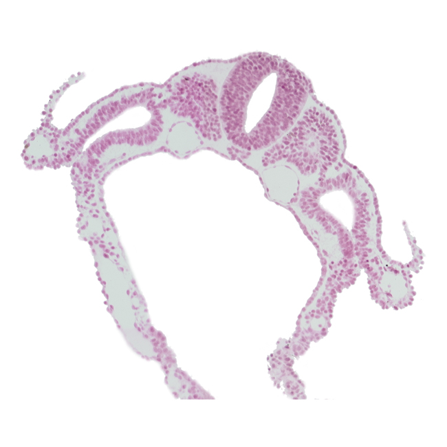 amnion attachment, dermatomyotome 6 (C-2), lateral body fold, left umbilical vein, right umbilical vein, sclerotome, somitocoel 6