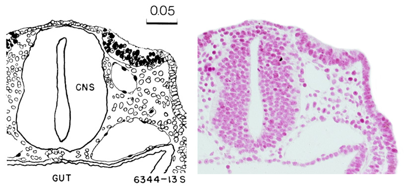 Otic plate