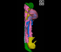 Embryo