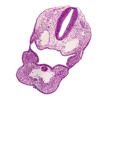 aortic sac, dermatomyotome 1 (O-1), dorsal aorta, perinotochordal lamina, pharyngeal arch 3, pharyngeal groove 1, pharyngeal groove 2, pharyngeal groove 3, pharyngeal pouch 3, precardinal vein