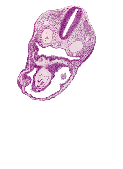 aortic sac, dermatomyotome 2 (O-2) , dorsal aorta, notochord, pericardial cavity, pharyngeal pouch 3, pharynx, rhombencephalon (Rh. D)