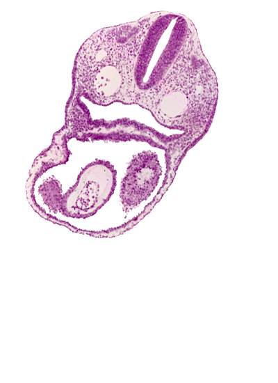 caudal edge of dermatomyotome 2 (O-2), cephalic parts of conus cordis, dorsal aorta, ectodermal ring, junction of conus cordis and truncus arteriosus, left atrium, pericardial cavity, pharyngeal pouch 4 recess, precardinal vein, truncus arteriosus