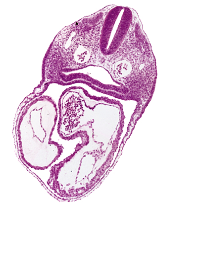 cardiac jelly, conus cordis, dermatomyotome 3 (O-3) , dorsal aorta, ectoderm, interatrial foramen (primum), interatrial sulcus, junction of conus cordis and right ventricle, left atrium, left ventricle, mesoderm, notochord, pericardial cavity, pharynx, primary interatrial septum (septum primum), rhombencephalon (Rh. D), right atrium