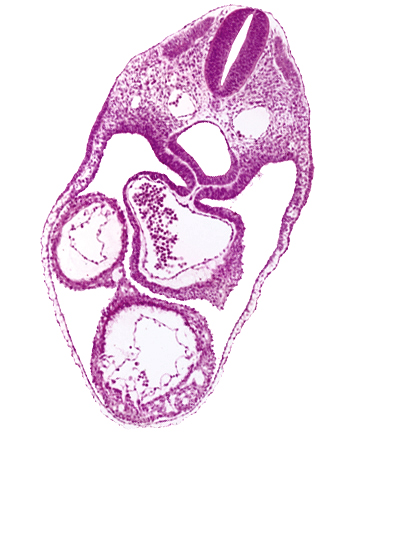 common atrium, dermatomyotome 4 (O-4) , dorsal aorta, ectodermal ring, foregut, laryngotracheal groove, mesocardium, pericardial cavity, precardinal vein, rhombencephalon (Rh. D)