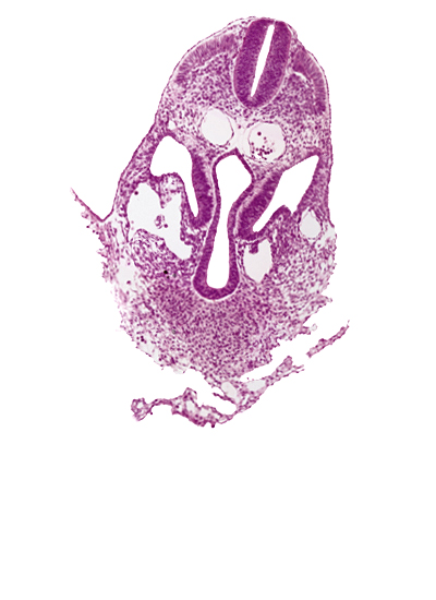 amnion, amnion attachment, amniotic cavity, caudal edge of pericardial cavity, dermatomyotome 6 (C-2), dorsal aorta, extra-embryonic coelom, junction of hepatic and umbilical veins, left umbilical vein, left vitelline (omphalomesenteric) vein, notochord, peritoneal cavity, right umbilical vein, right vitelline (omphalomesenteric) vein, septum transversum