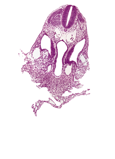 caudal edge of dermatomyotome 6 (C-2), dorsal aorta, junction of septum transversum and umbilical vesicle, left vitelline (omphalomesenteric) vein, midgut, notochord, origin of dorsal intersegmental artery, peritoneal cavity, septum transversum, specialized coelomic wall, umbilical vesicle wall