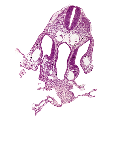 amnion attachment, communication between peritoneal cavity and extra-embryonic coelom, dermatomyotome 7 (C-3), dorsal aorta, extra-embryonic coelom, left umbilical vein, mesothelium of umbilical vesicle, midgut, notochord, right umbilical vein, septum transversum, umbilical vesicle wall