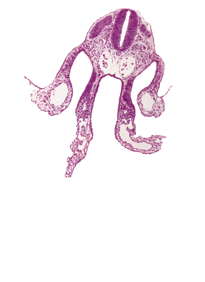 amnion attachment, caudal edge of dermatomyotome 7 (C-3), midgut, notochord, peritoneal cavity, primary umbilical vesicle stalk, right umbilical vein, specialized coelomic wall, surface ectoderm, umbilical vesicle cavity, umbilical vesicle wall