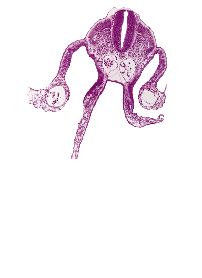 amnion attachment, dermatomyotome 9 (C-5), left umbilical vein, midgut, peritoneal cavity, presumptive upper limb bud, primordial omental bursa, right umbilical vein, somatopleure, splanchnopleure, surface ectoderm