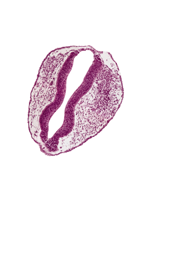 mesencephalon (M2), mesencoel, rhombencephalon (Rh. 1), rhombencephalon (Rh. 2), rhombencoel (fourth ventricle), roof plate, surface ectoderm, trigeminal neural crest (CN V)