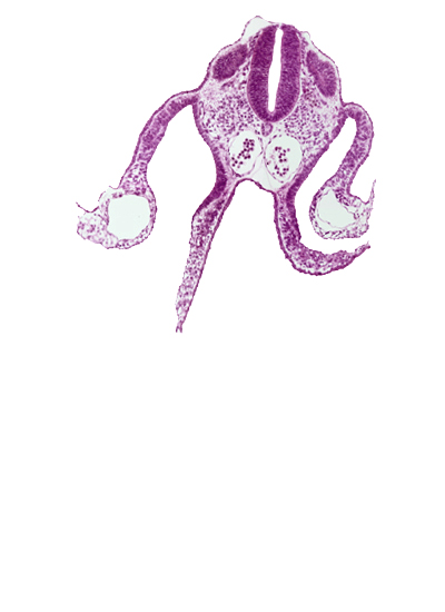 amnion attachment, dermatomyotome 9 (C-5), dorsal aorta, midgut, peritoneal cavity, presumptive upper limb bud, primordial omental bursa, right umbilical vein, somatopleure, splanchnopleure