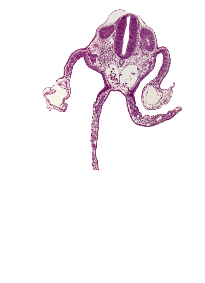 adjacent dorsal aortas, dermatomyotome 10 (C-6), mesonephric duct, mesonephric vesicle(s), midgut, nucleated red blood cells, perinotochordal lamina, primordial omental bursa, sclerotome, separation artifact, somitocoel