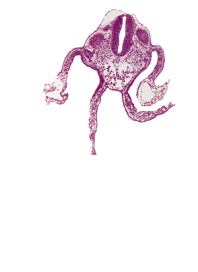 artifact separation(s), caudal edge of dermatomyotome 10 (C-6), communication between dorsal aortas, left umbilical vein, lumen of neural tube, mesonephric vesicle(s), midgut, peritoneal cavity, presumptive upper limb bud, primordial omental bursa