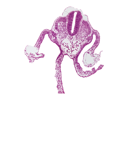 amnion attachment, amniotic cavity, artifact separation(s), dermatomyotome 11 (C-7), left umbilical vein, mesonephric vesicle(s), midgut, peritoneal cavity