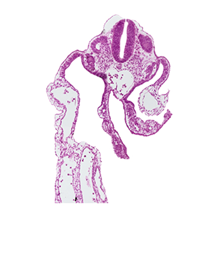 common umbilical artery, dermatomyotome 11 (C-7), dorsal aorta, endoderm, mesonephric vesicle(s), midgut, splanchnopleuric mesoderm