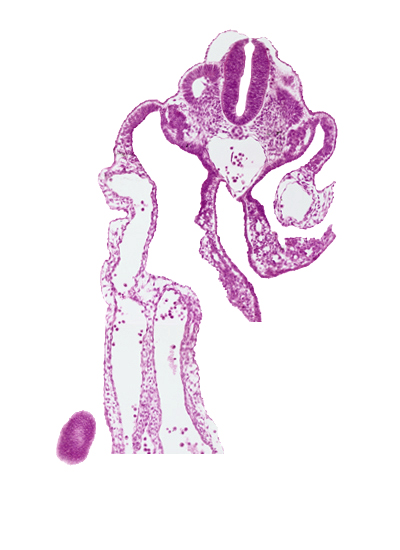 aorta, caudal edge of caudal eminence, caudal edge of dermatomyotome 11 (C-7), caudal edge of midgut, cephalic edge of dermatomyotome 12 (C-8), common umbilical artery, dermatomyotome 11-12 intersegmental region, right umbilical vein