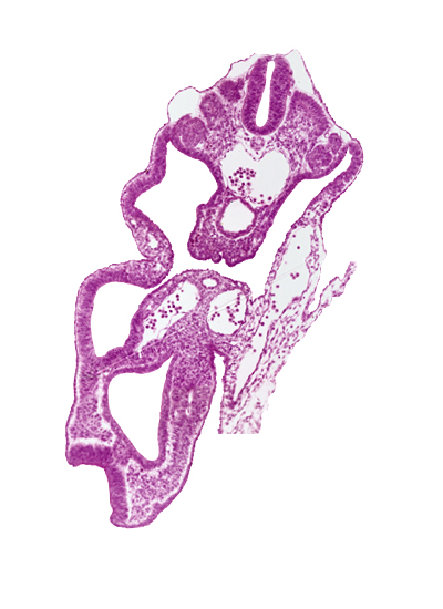 allantois, aorta, cephalic edge of dermatomyotome 14 (T-2), cloaca, hindgut, junction of left umbilical vein, left umbilical artery, mesonephric duct, mesonephric vesicle(s), notochord, peritoneal cavity, right umbilical artery