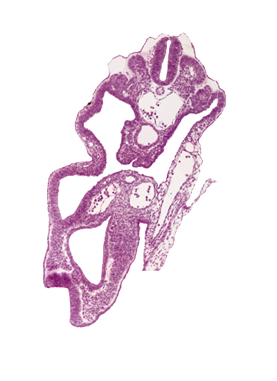 allantois, aorta, cloaca, dermatomyotome 14 (T-2), hindgut, left umbilical artery, notochord, peritoneal cavity, right umbilical artery