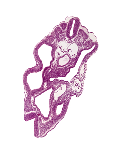 cloaca, dermatomyotome 15 (T-3), hindgut, left umbilical artery, left umbilical vein, mesonephric duct, peritoneal cavity