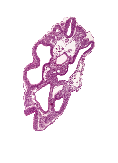 caudal neuropore, cloaca, dermatomyotome 15 (T-3), junction of cloaca and mesonephric duct, left common iliac artery, left umbilical artery, left umbilical vein, mesonephric vesicle(s), neural fold, perinotochordal lamina, right common iliac artery
