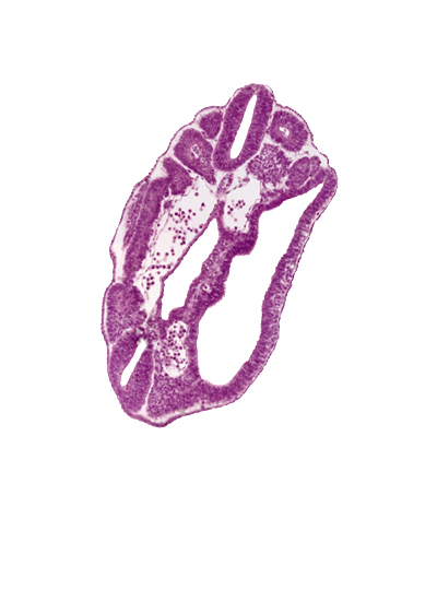 dermatomyotome 16 (T-4), hindgut, left common iliac artery, neural tube, peritoneal cavity, sclerotome, surface ectoderm