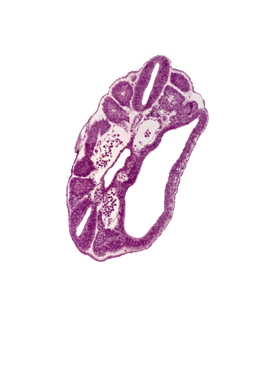 dermatomyotome 16 (T-4), hindgut, left common iliac artery, mesonephric duct, perinotochordal lamina, peritoneal cavity, right common iliac artery, somatopleure, somite 17 (T-5)