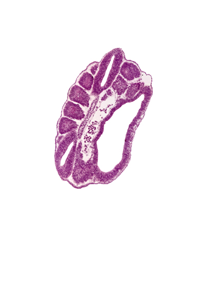 alar plate(s), basal plate, floor plate, intersegmental region, junction of aorta and left common iliac artery, neural tube, paraxial mesoderm, perinotochordal lamina, peritoneal cavity, roof plate, somatopleure, somite 17 (T-5), splanchnopleuric mesoderm, sulcus limitans, surface ectoderm