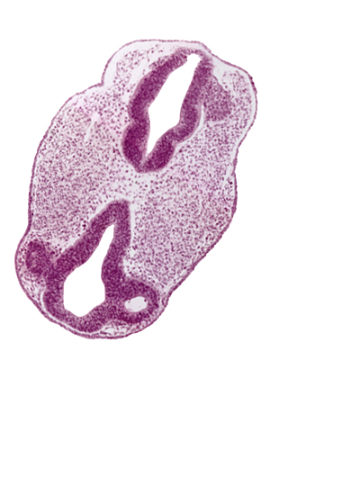 diencephalon (D1), diencephalon (D2), facio-vestibulocochlear neural crest (CN VII and CN VIII), region of mesencephalic (cephalic) flexure, rhombencephalon (Rh. 3), rhombencephalon (Rh. 4), venous plexus(es)