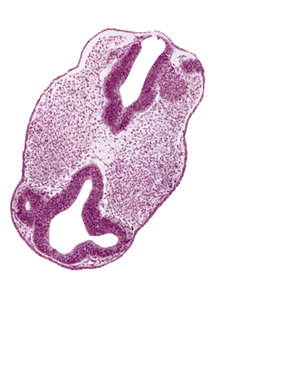 cephalic edge of otic vesicle, diencephalon (D1), diencephalon (D2), facio-vestibulocochlear neural crest (CN VII and CN VIII), intraretinal space (optic vesicle cavity), presumptive optic stalk (CN II), region of mesencephalic (cephalic) flexure, rhombencephalon (Rh. 3), rhombencephalon (Rh. 4), roof plate, venous plexus(es)