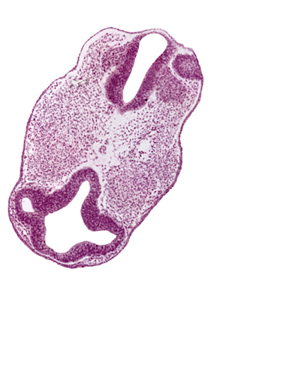 cephalic edge of dorsal aorta, cephalic edge of notochord, cephalic edge of otic vesicle, communication between intraretinal space (optic vesicle cavity) and prosencoel (third ventricle), diencephalon (D1), diencephalon (D2), facio-vestibulocochlear neural crest (CN VII and CN VIII), intraretinal space (optic vesicle cavity), optic vesicle (D1), prosencoel (third ventricle), rhombencephalon (Rh. 3), rhombencephalon (Rh. 4), vascular plexus