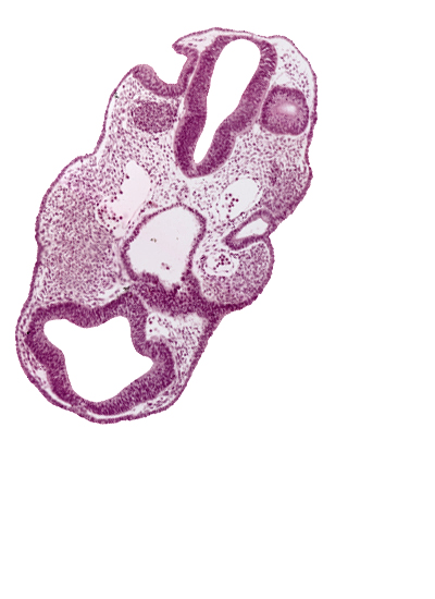 adenohypophysial pouch, caudal wall of otic vesicle, chiasmatic plate (D1), dorsal aorta, ectoderm, epipharyngeal placode 2, internal carotid artery, junction of aortic arch 1 and dorsal aorta, junction of notochord and pharyngeal wall, neuropore site, pharyngeal arch 1, pharyngeal groove 1, pharyngeal pouch 1, rhombencephalon (Rh. 4), rhombencephalon (Rh. 5)