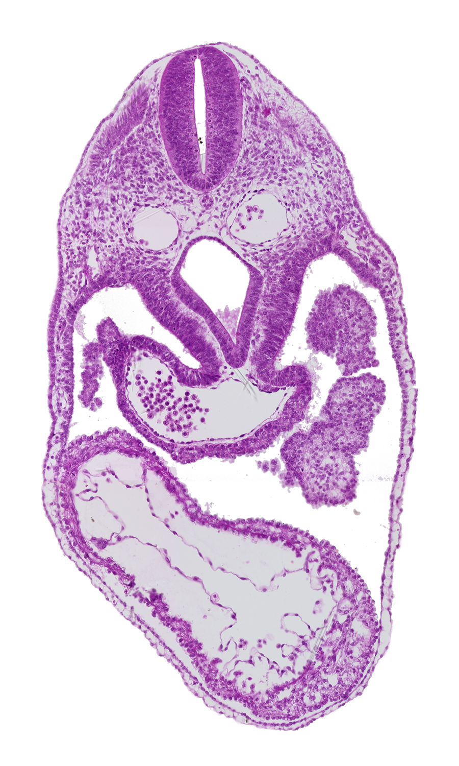 dermatomyotome 4-5 intersegmental region, dorsal aorta, foregut, interventricular foramen, junction of rhombencephalon and spinal cord, left ventricle, pericardial cavity, precardinal vein, right ventricle, septum transversum, sinus venosus
